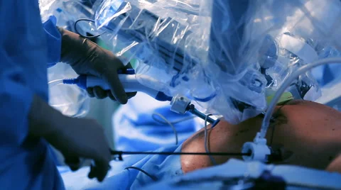 Surgery In The Operating Robotic Technology Stock-Footage 64552734
