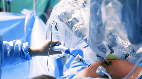 Surgery In The Operating Robotic Technology Stock-Footage 64553029