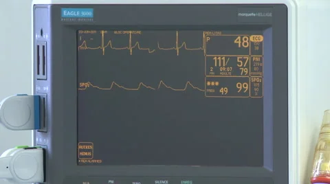 Surgery in an operating room Stock Footage 53810138