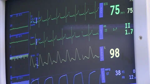 Surgery in an operating room Stock Footage 53810442