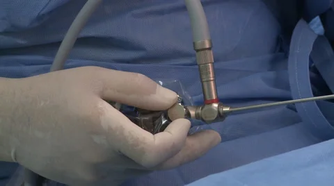 Surgery in an operating room Video stock 53817069