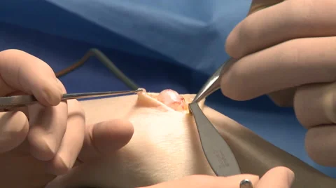 Surgery in an operating room Stock Footage 53819255