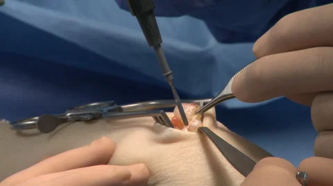 Surgery in an operating room Stock Footage 53820198