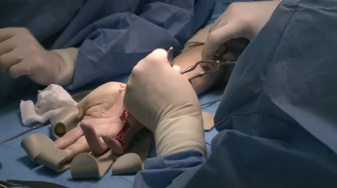 Surgery in an operating room Video stock 53824747