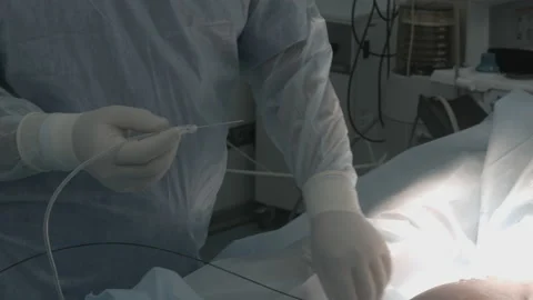 Surgery in the operating room. Operating room Video stock 143160211