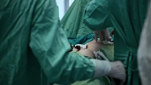 Surgery operation. Close up of surgery hands. Surgical treatment concept Video stock 223013800
