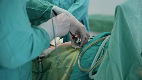 Surgery operation. Close up of surgery hands. Surgical treatment concept Video stock 223013838