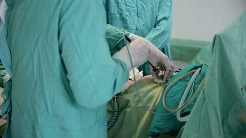 Surgery operation. Close up of surgery hands. Surgical treatment concept Stock Footage 231052125