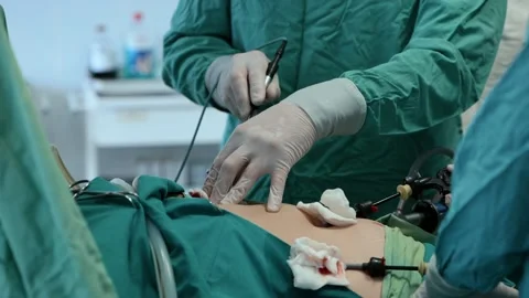 Surgery operation. Close up of surgery hands. Surgical treatment concept Video stock 236683594