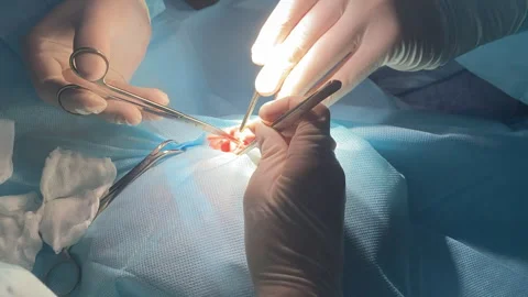 Surgery operation. Close up of surgery hands take off wadding tampon in blood Stock Footage 242935933