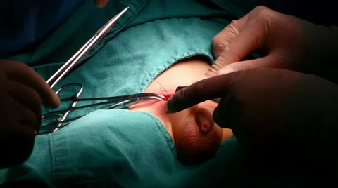 Surgery operation, general view in hospital Stock Footage 59081059