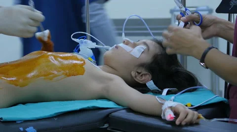 Surgery operation, general view in hospital Stock Footage 59083711