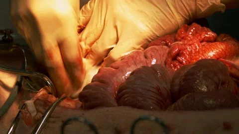 Surgery operation on a heart where guts are pulled out by doctors in uniform Stock Footage 199523721