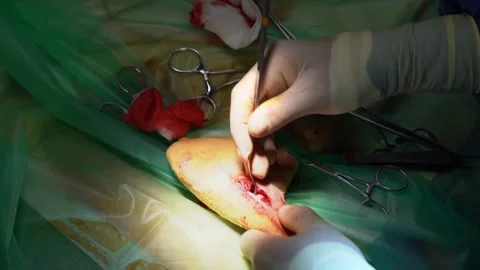 Surgery operation veterinary cat broken Leg video 動画素材 248511786