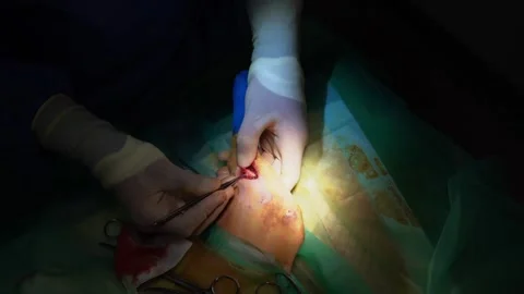 Surgery operation veterinary cat broken Leg video footage Vídeo Stock 248511805