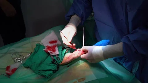 Surgery operation veterinary cat broken Leg Vídeo Stock 248512179