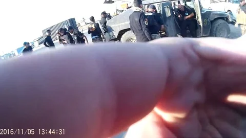 Surgery operation in war zone, Syria 2016 Stock Footage 70279392