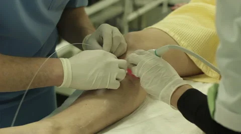 Surgery on the Patient's Leg Stock Footage 53028515
