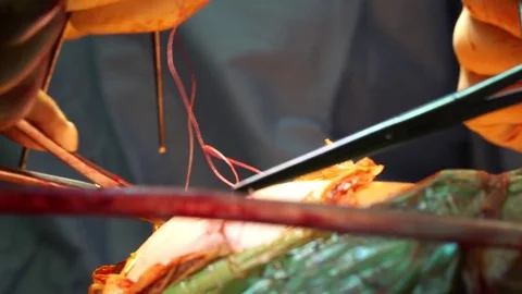 Surgery people Stockbeeldmateriaal 83316219