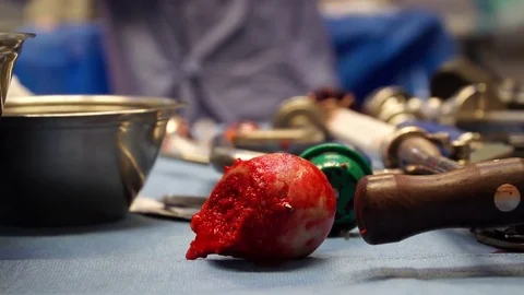 Surgery people Stockbeeldmateriaal 83317210