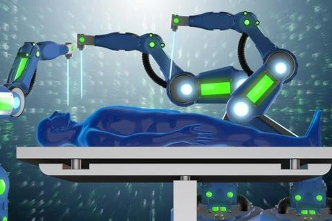 Surgery performed by robotic arm - 3D rendering Stock Illustration