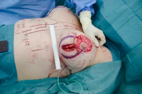 Surgery Stock Photos