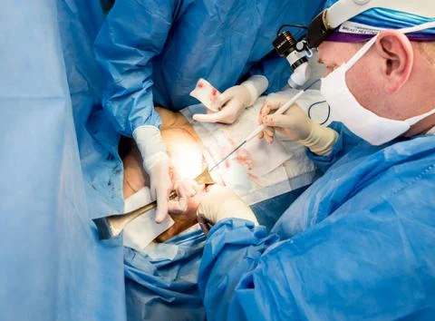 Surgery to remove the breast and replace it with an implant. Stock Photos