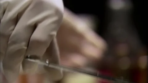 Surgery to remove shrapnel Stock Footage 235264674