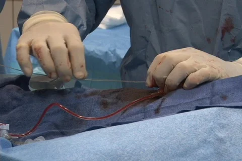 Surgery Room 09 Stock Footage 862235