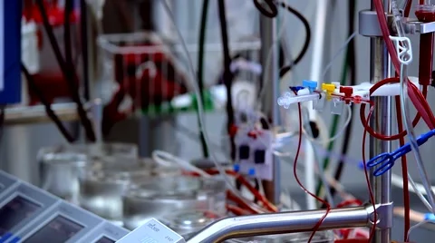 Surgery Room Heart-lung machine Stock Footage 44239698