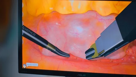 Surgery Simulator Machine Video stock 105820444