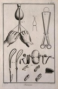 Surgery: surgical instruments for the removal of polyps from the uterus. En.. Stock Illustration