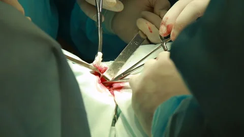 Surgery team operating Stock Footage 86598393