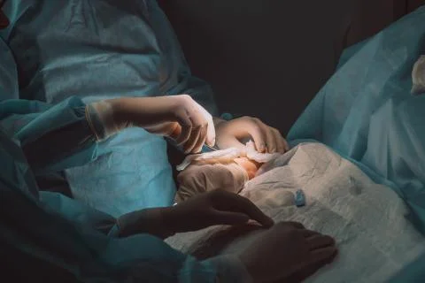 Surgery on vessels; process of operation; surgery room Stock Photos
