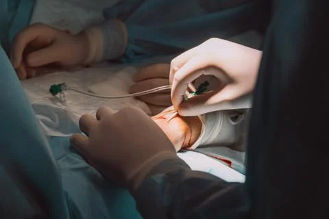 Surgery on vessels; process of operation; surgery room Stock Photos