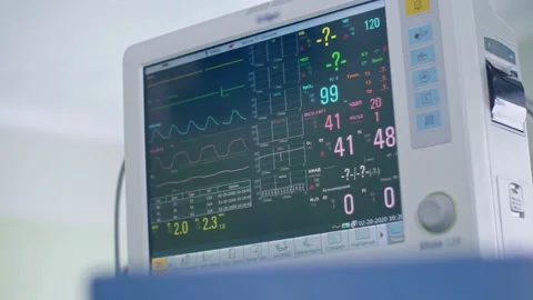 Surgical anesthesia machine in operating room shows indicators of life and pulse Stock Footage 150885063
