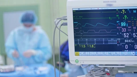 Surgical anesthesia machine in operating room shows indicators of life and pulse Stock Footage 150890493