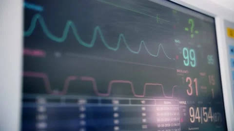 Surgical anesthesia machine in operating room shows indicators of life and pulse Stock Footage 150891169