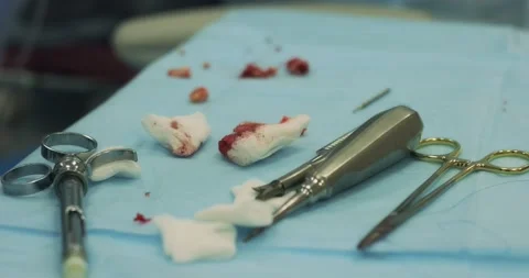 Surgical dental instruments on the table during tooth extraction surgery Stock Footage 166203470