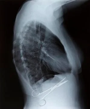 Surgical errors; conceptual image Foto stock