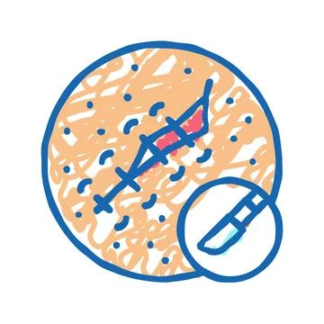Surgical excision mole removal icon doodle illustration Stock Illustration