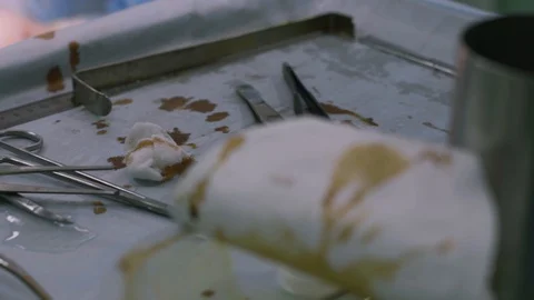 Surgical instruments and instruments in the operating room, during surgery Stock Footage 129177976