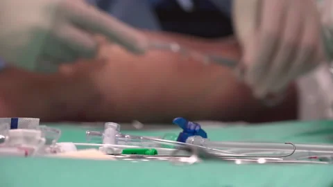 Surgical Instruments and Surgery in the background Stock Footage 239700359