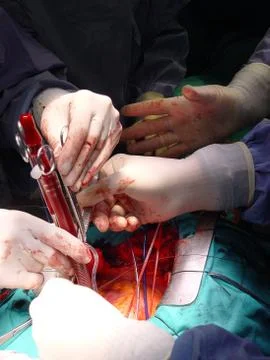 A surgical intervention Stock Photos
