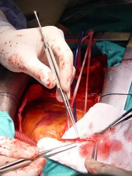 A surgical intervention Stock Photos