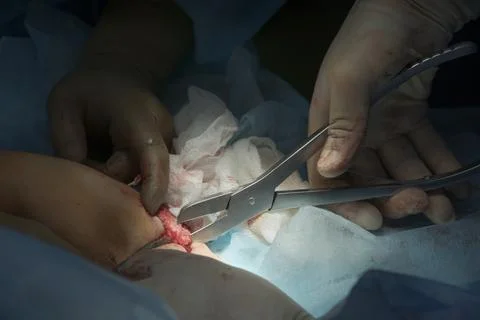 Surgical Nippers Usage With Bone Photos