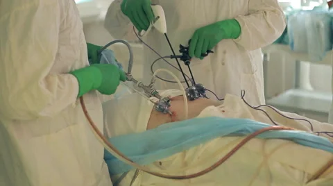 Surgical operation on the abdomen Stock Footage 62407766