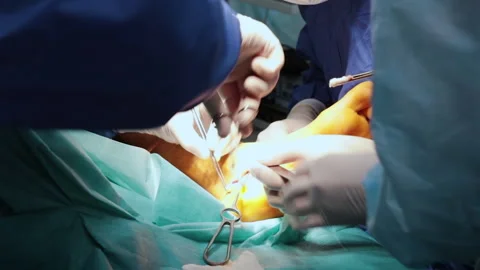 Surgical operation on the leg in the operating room Stock Footage 237692625