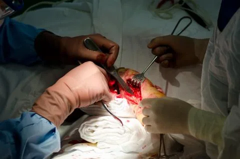 Surgical operation Stock Photos