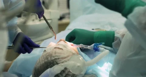 Surgical operation to remove a tooth under anesthesia Stock Footage 166203574